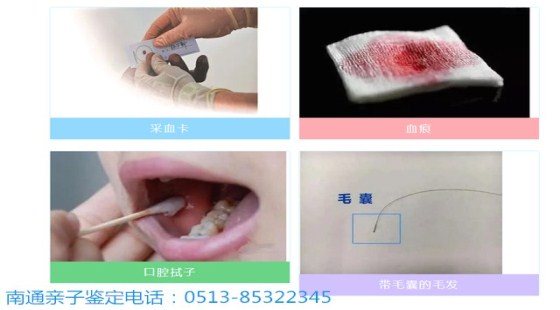 南通隐私亲子鉴定怎么做/南通正规亲子鉴定在哪里？